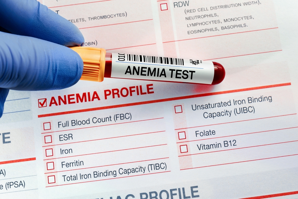 Blood sample for analysis of Anemia profile test in laboratory. doctor holding Blood tube test with requisition form for Anaemia test