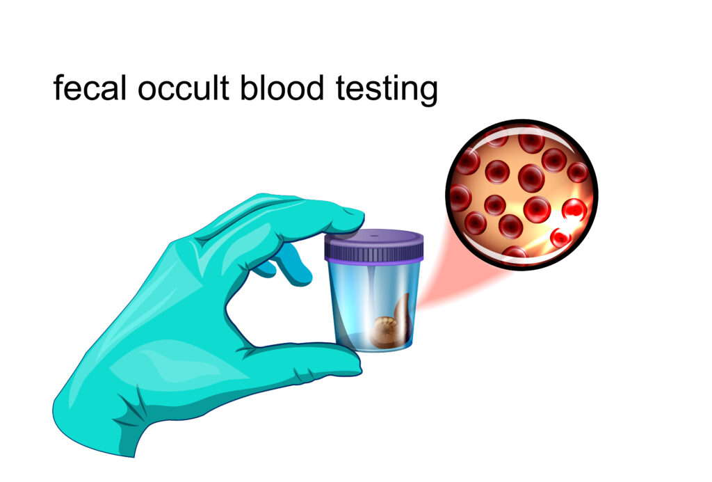 fecal occult blood testing. vector illustration