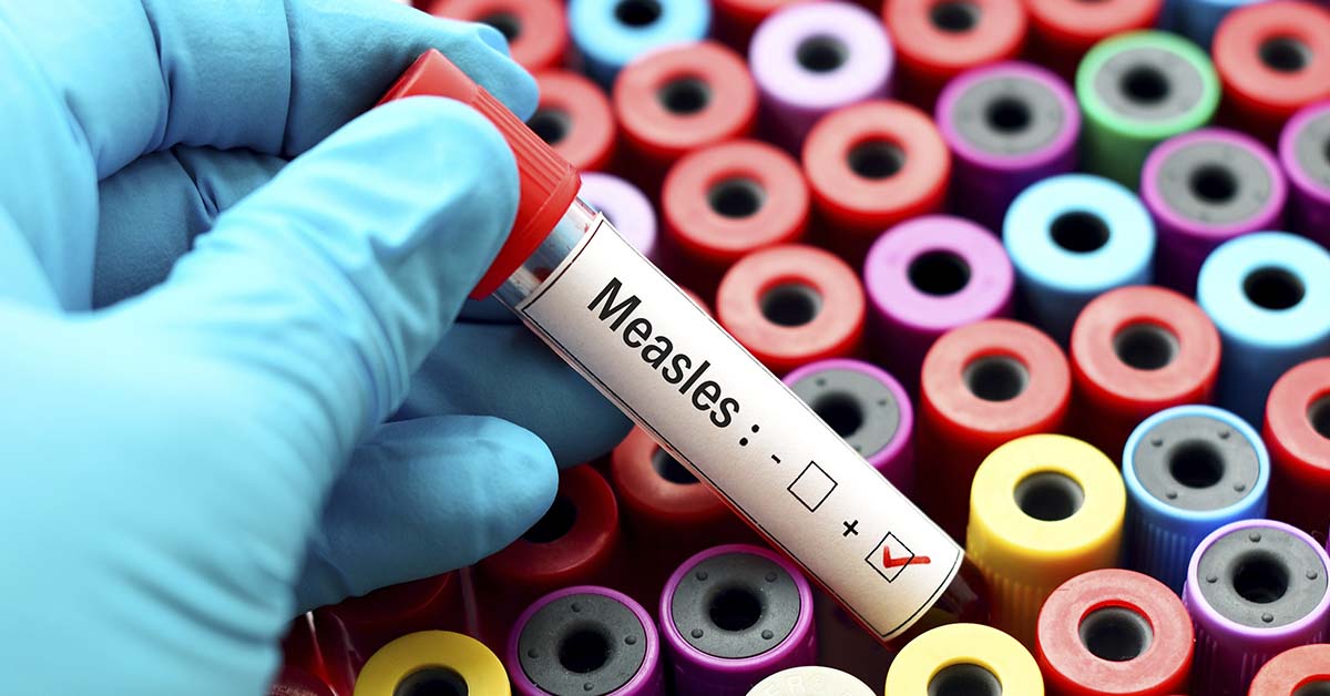 Canada Lost Its Measles Free Status, Is The U.S. Next?