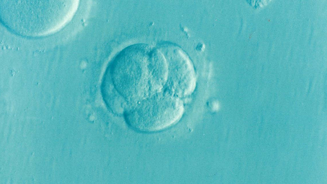 a human egg