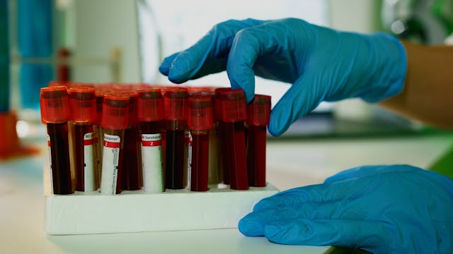 blood vials