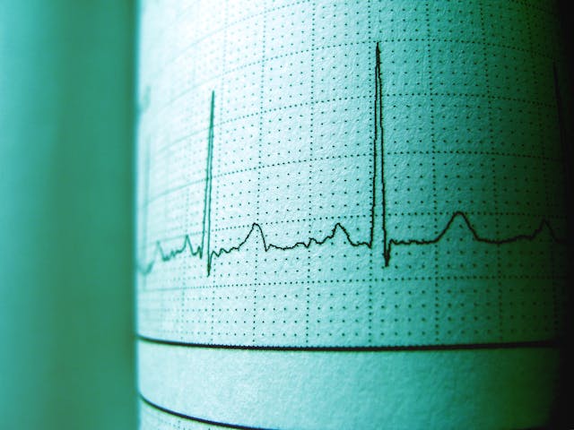 heart beat