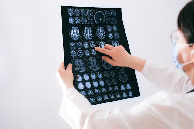 doctor pointing at scans
