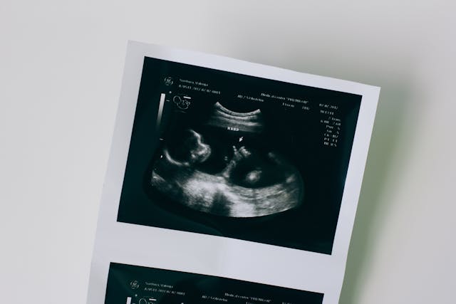 photo of embryo