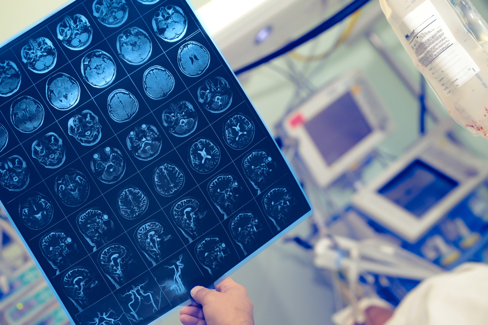 MRI in the hand of medical worker in the hospital ward.