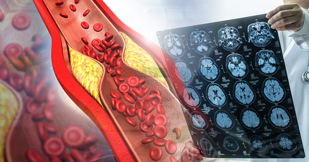 3 Morning Habits to Avoid if You Have High Blood Pressure or Cholesterol