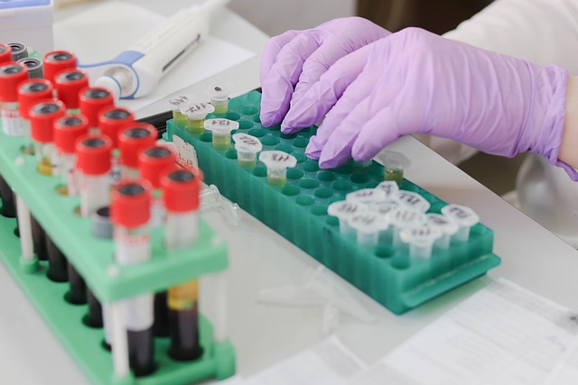 samples being placed in a container