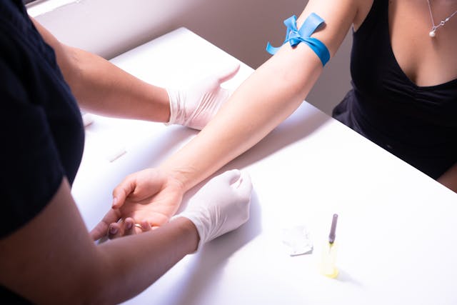 arm prepared for drawing blood