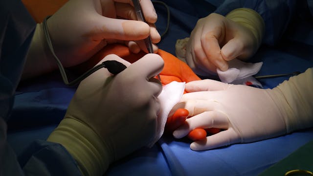 surgeons performing surgery
