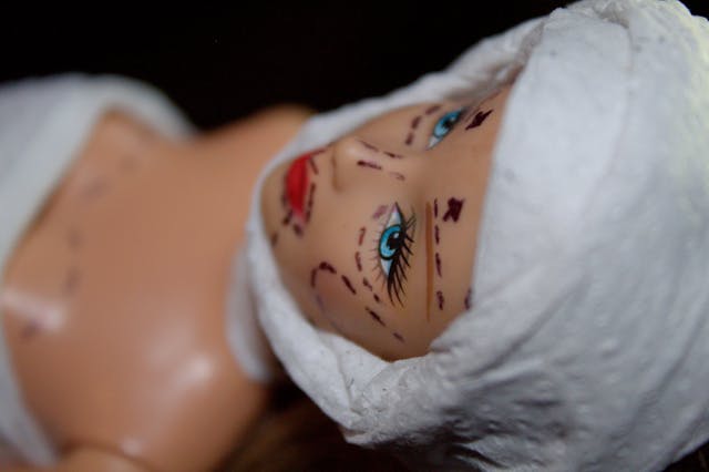doll with surgery marks