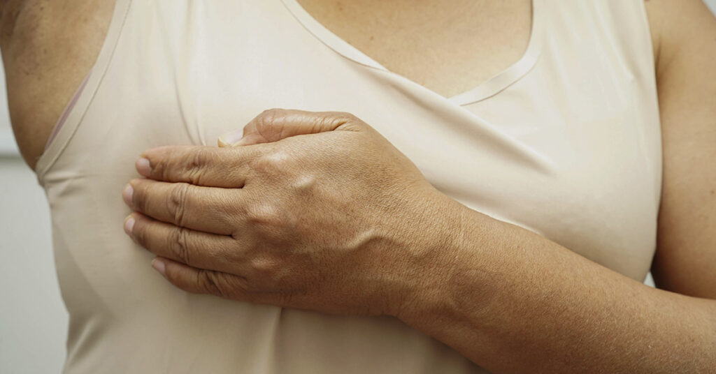 Common Causes of Underboob Rashes, How to Treat, and When To See A Doctor - Featured image