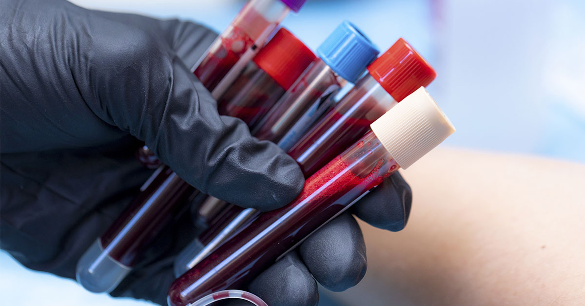 Golden Blood: Why the World’s Rarest Blood Type Is So Important