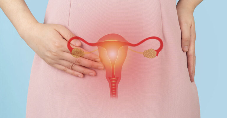 These 5 Early Signs of Vaginal Cancer Should Never Be Ignored - Featured image