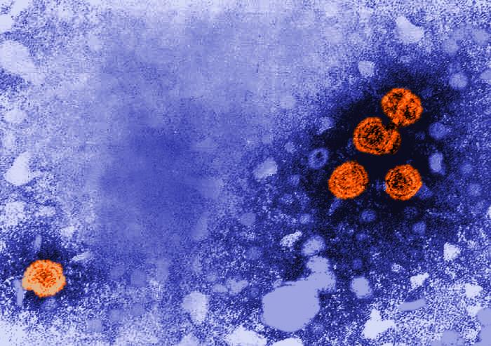 Transmission electron microscope image of rotavirus particles, dozens of round viral spheres with a distinctive wheel-like structure visible on their surfaces, stained purple against a light background.