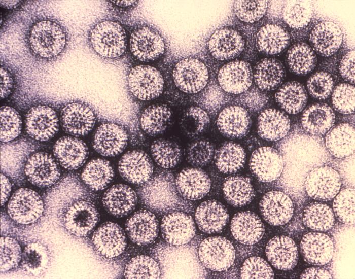 Hidden Dangers of Hidradenitis Suppurativa That Everyone Should Know - Featured image