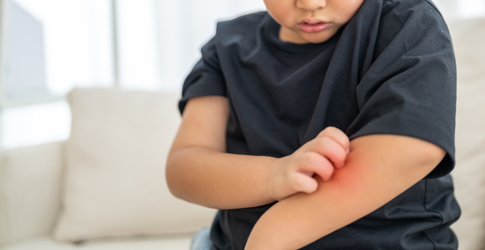 Young asian boy concerned expression itch or skin irritation, children allergy, particularly those related to skin care and health, childhood, health, skin care and medical attention daily life