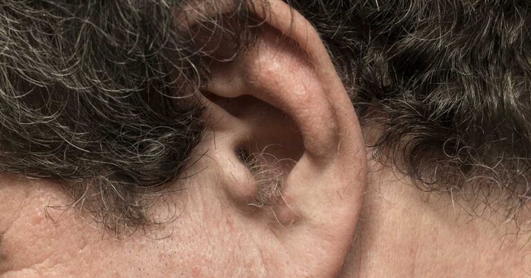 Why Do I Have So Much Ear Hair? Causes, Age Effects, and Removal Options - Featured image