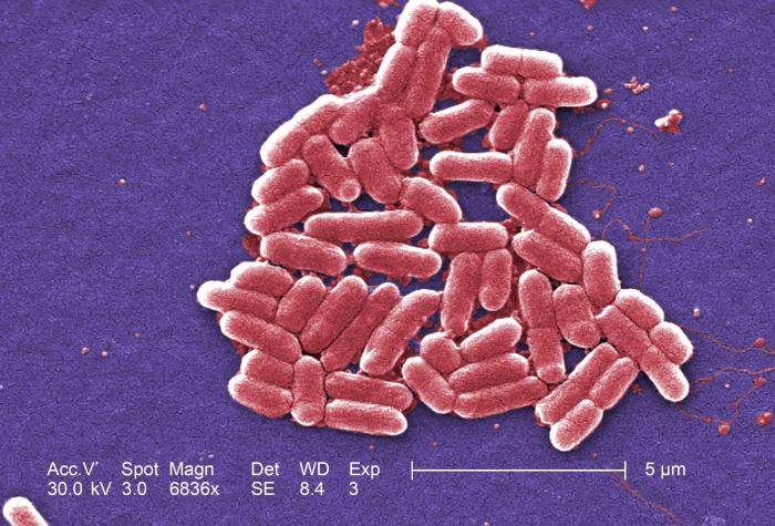 Colorized electron microscope image of rod-shaped bacteria clustered together against a blue-purple background, with scale bar showing 5 micrometers and technical imaging data in the corner.