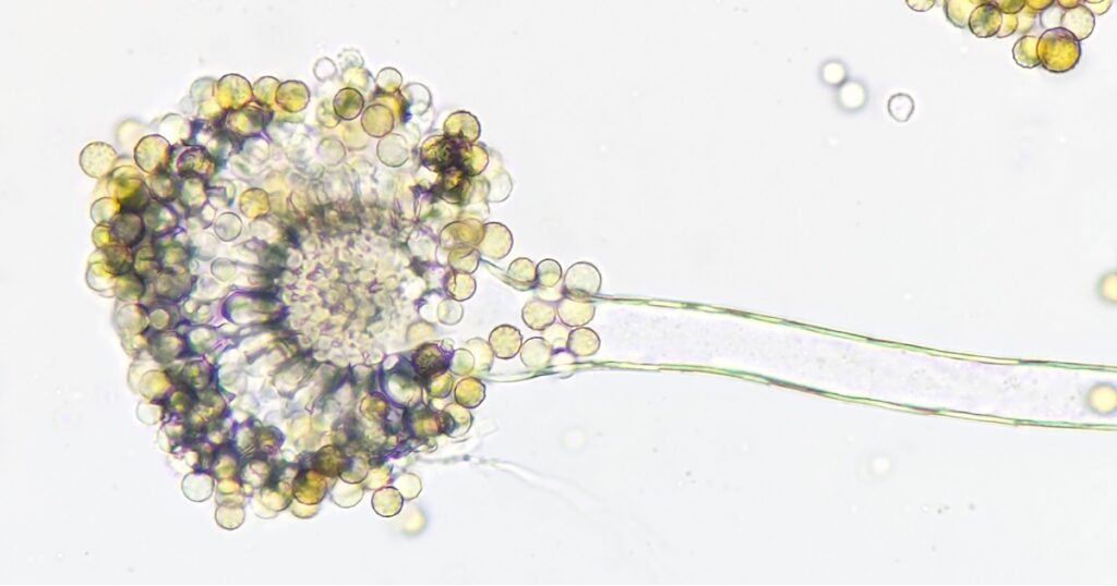 Rising Infections Put Several U.S. States on Alert Over Potentially Deadly Fungus - Featured image