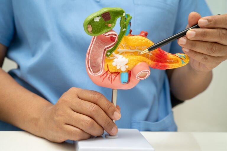 The Biggest Breakthrough in Pancreatic Cancer in Decades is Here - Featured image