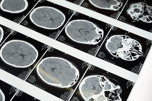 brain scan