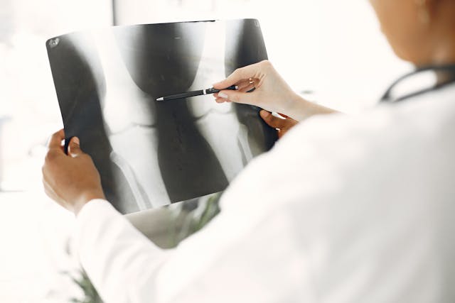 doctor examining leg x-ray