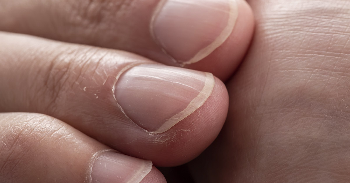 What the Lines on Your Nails Could Be Telling You About Your Health