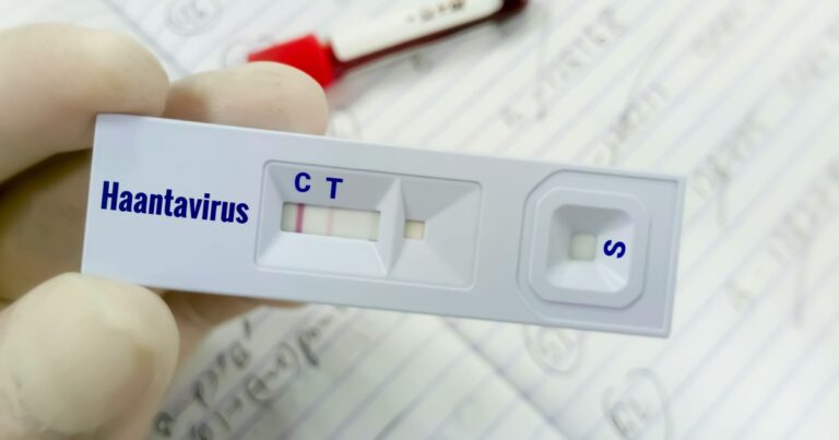 Is Hantavirus the Next COVID? A Complete 2026 Guide - Featured image