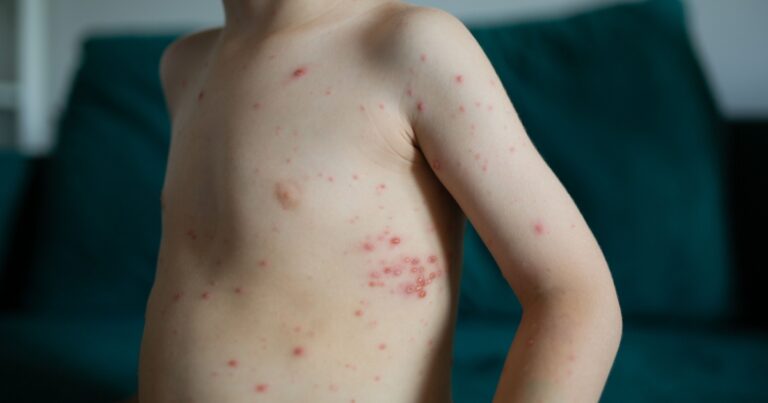 The Childhood Virus Silently Linked to Dementia — And What to Do About It - Featured image