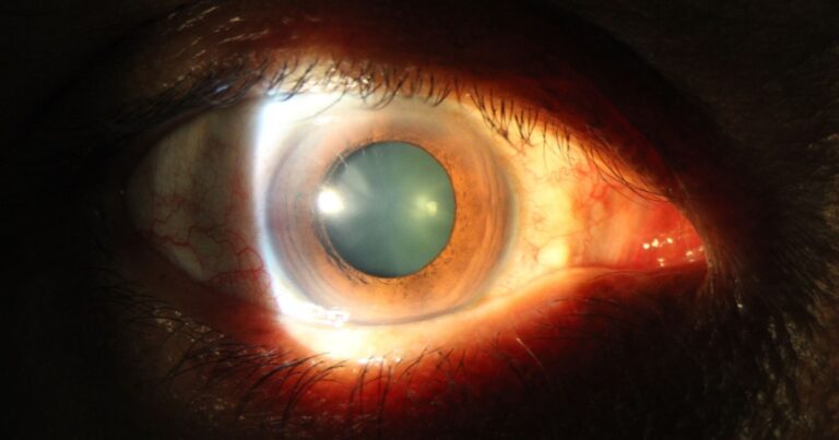 Simple Test That May Predict Death Within 24 Hours - Featured image