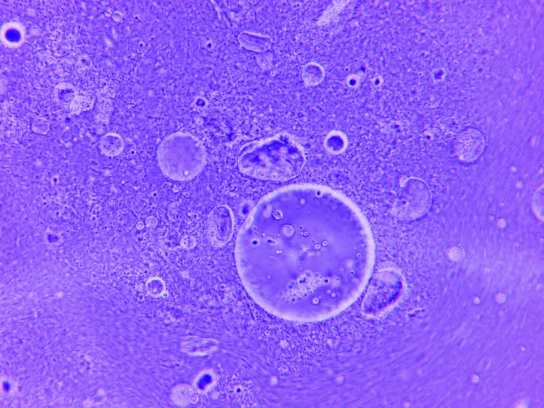 Lab-Grown Brain Cells Are Now Powering Real Computers — Here’s How