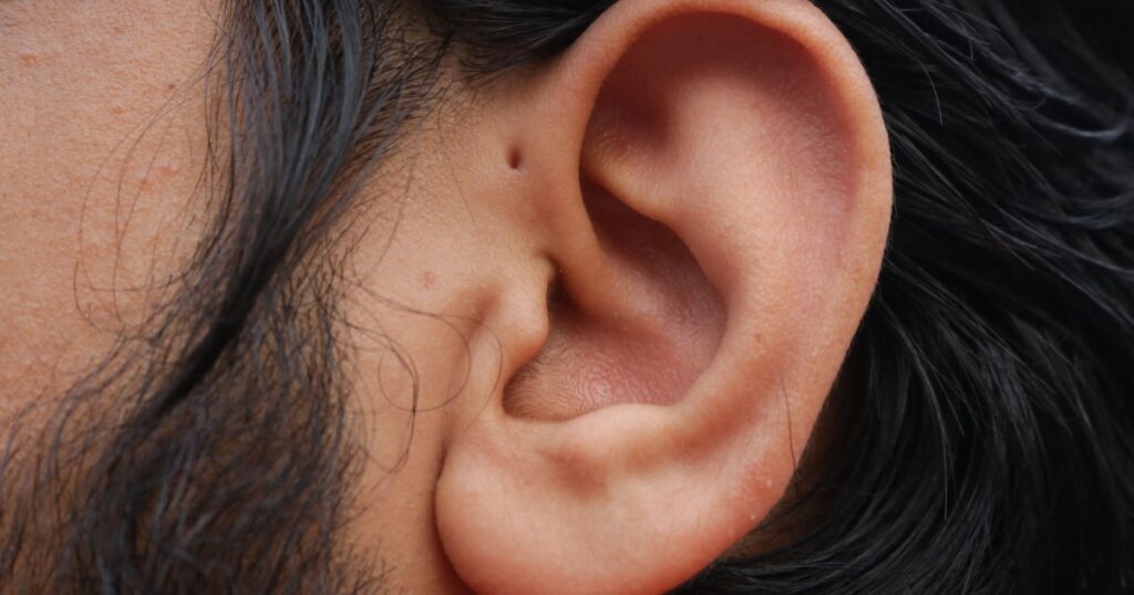 People With a Tiny Hole Above the Ear Have an Exceptionally Rare Trait - Featured image