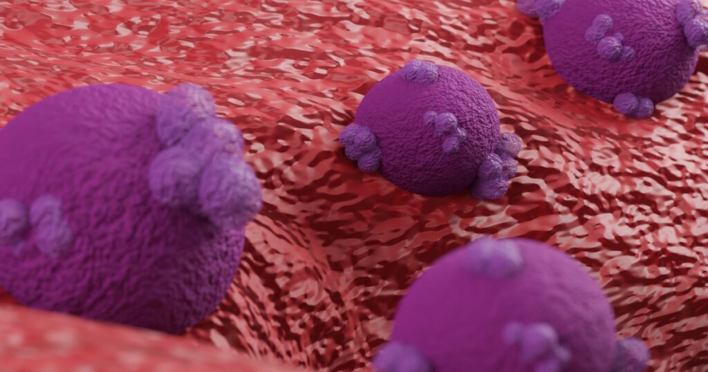 From Gut Bacteria to DNA Repair: The Discoveries Reshaping Ovarian Cancer Research - Featured image