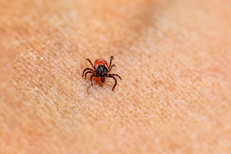 Tick Bite ER Visits Are at a 9-Year High. Here’s How to Stay Safe - Featured image