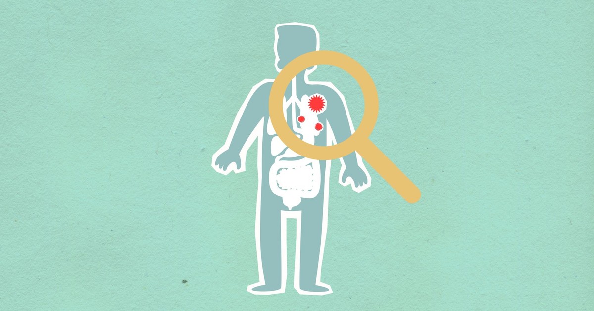 Paper cutout of man under magnifying glass with red viruses spreading on internal organs on green background during disease propagation