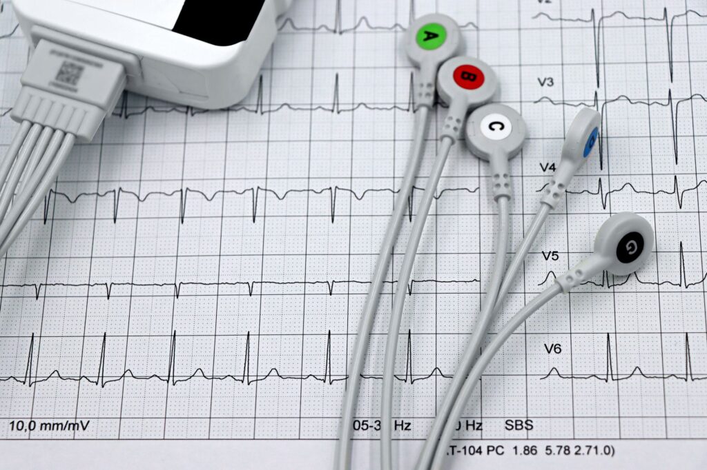 99% of Heart Attacks and Strokes Share These 4 Risk Factors - Featured image