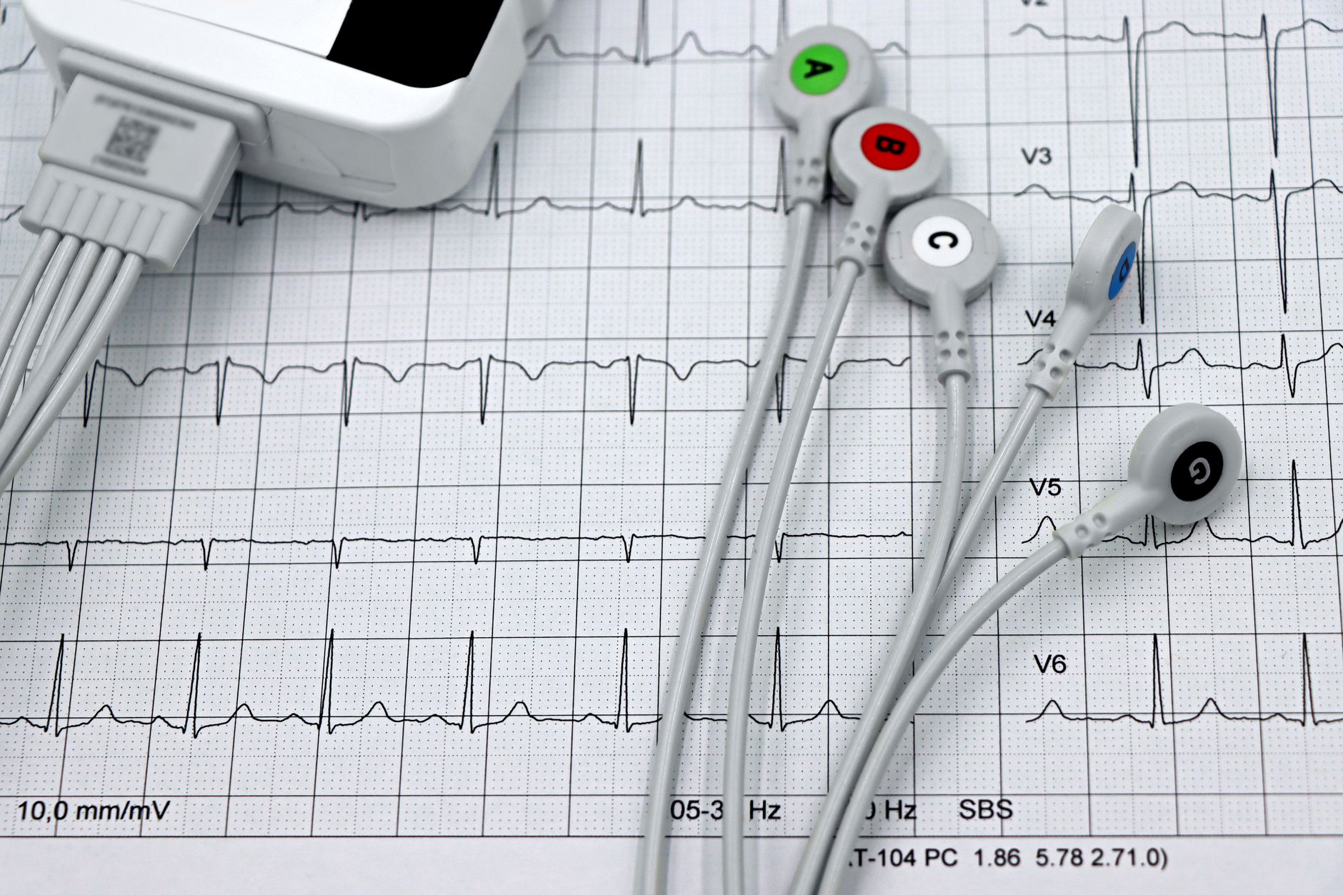 99% of Heart Attacks and Strokes Share These 4 Risk Factors