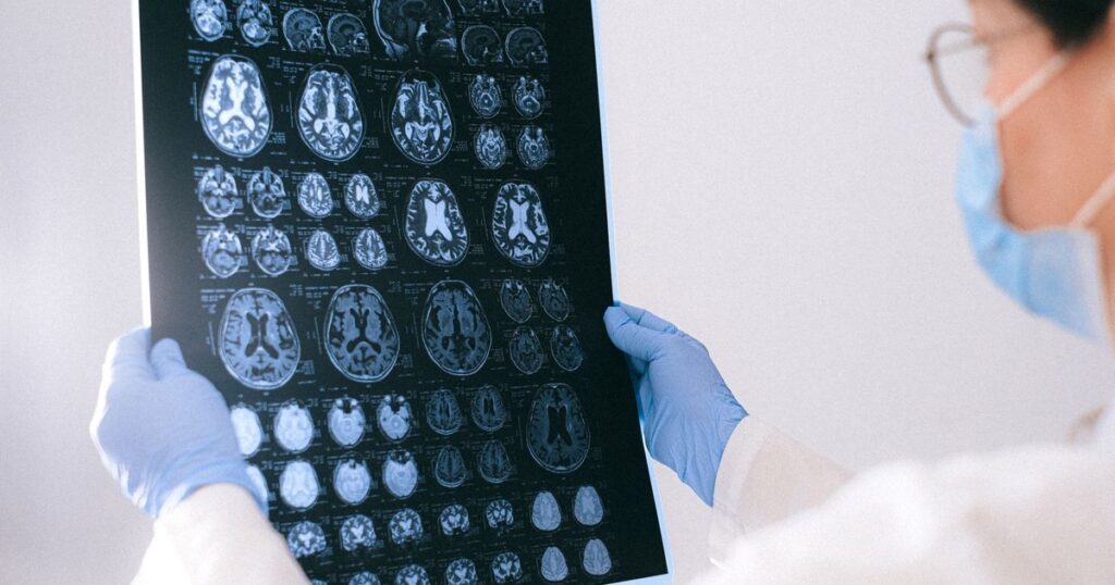 3 Sleep Habits Quietly Accelerating Brain Aging, Study - Featured image