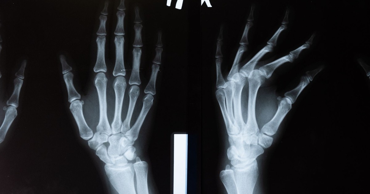 High-resolution x-ray image showing the intricate anatomy of human hands.
