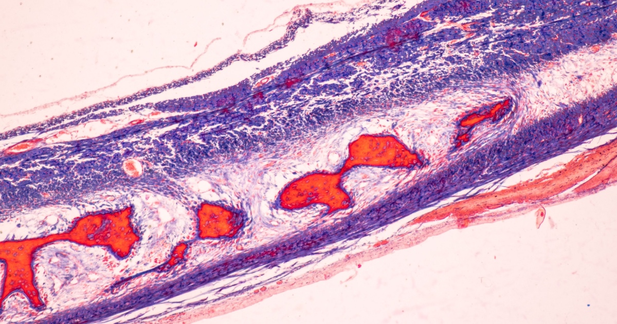 Scientists Found a Fat-Burning Switch Hidden Inside Every Cell