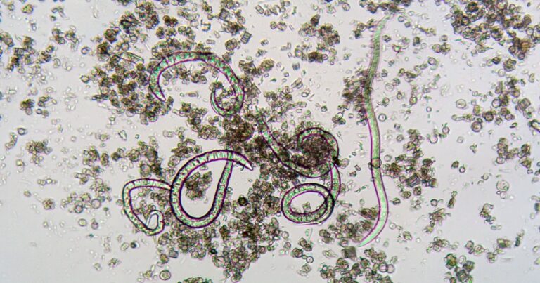 Over 1,400 Hit by ‘Explosive Diarrhea’ Parasite in Michigan and Ohio — No Source Found Yet - Featured image