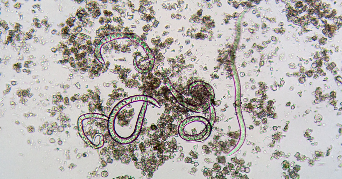 Over 1,400 Hit by ‘Explosive Diarrhea’ Parasite in Michigan and Ohio — No Source Found Yet