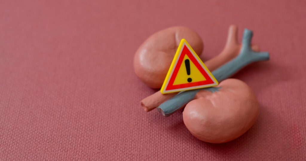 12 Kidney Disease Signs Most People Completely Miss Until It’s Too Late - Featured image