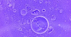 Two Alzheimer's Drugs Are Now Being Tested to Prevent Dementia Before It Starts Blue abstract image of water droplets and particles under a microscope.