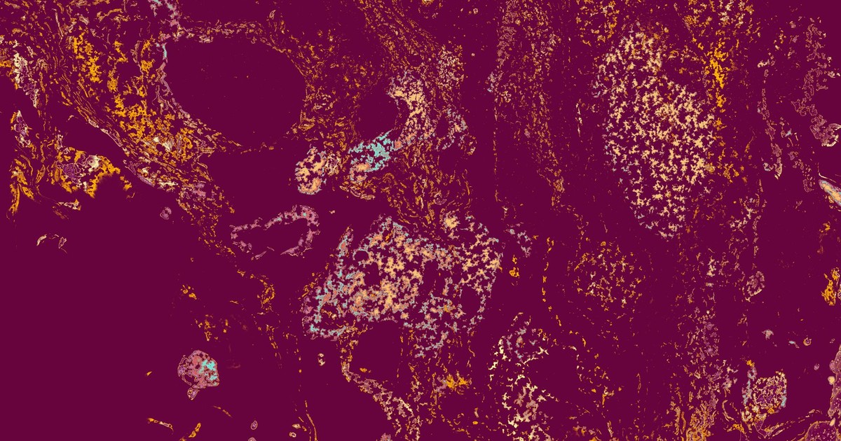Dynamic marbled abstract art with rich purple and yellow swirls creating a mesmerizing pattern.