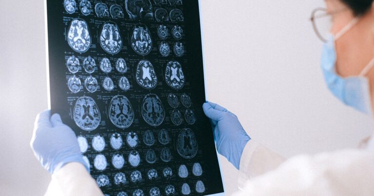 Scientists Find an Earlier Warning Sign of Alzheimer’s Than Memory Loss - Featured image