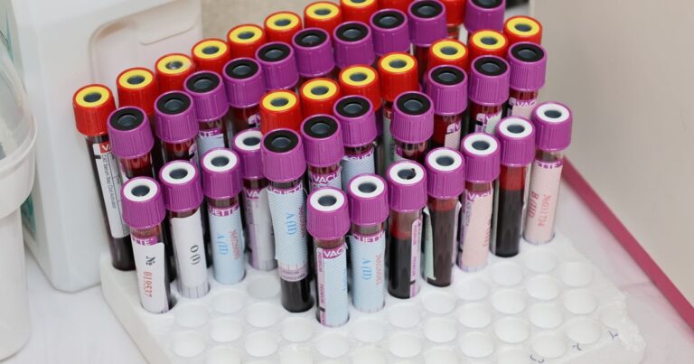 New Alzheimer’s Blood Test Predicts Risk Up to a Decade Before Symptoms Appear - Featured image