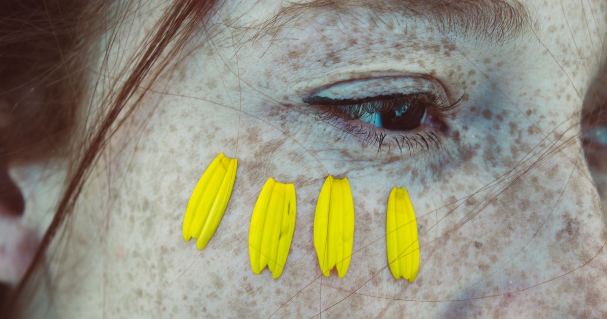 Artistic close-up of a freckled face adorned with yellow petals near the eye.
